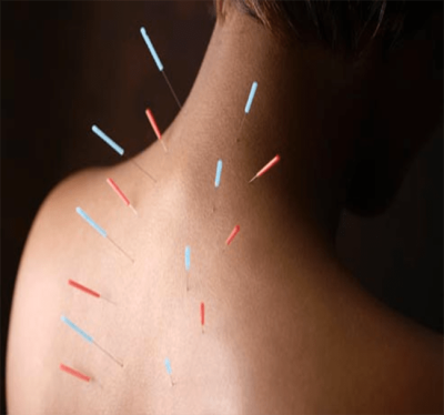 ACUPUNCTURE Πειραιάς