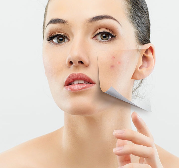 COSMETIC ACUPUNCTURE