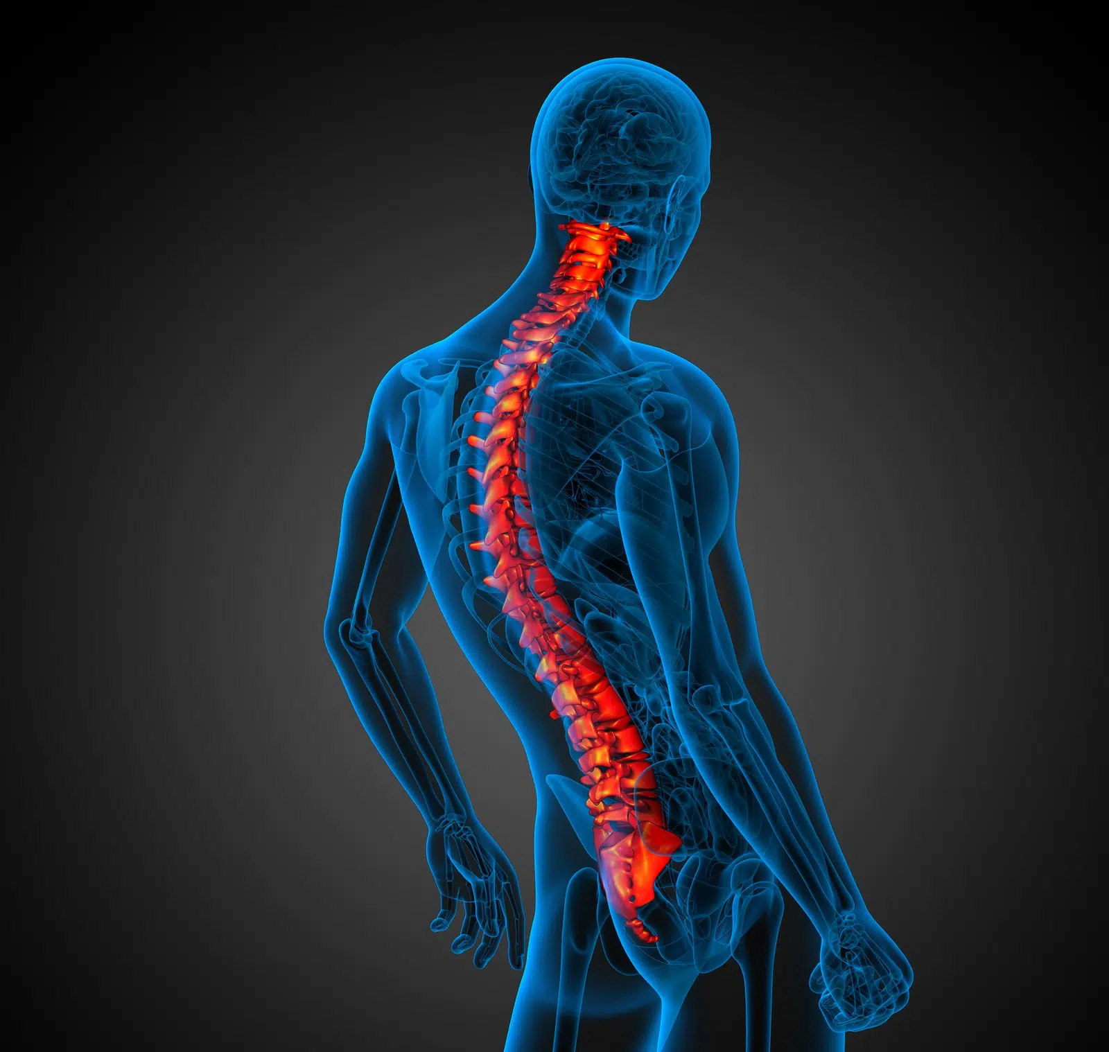 Scoliosis Scoliosis Piraeus
