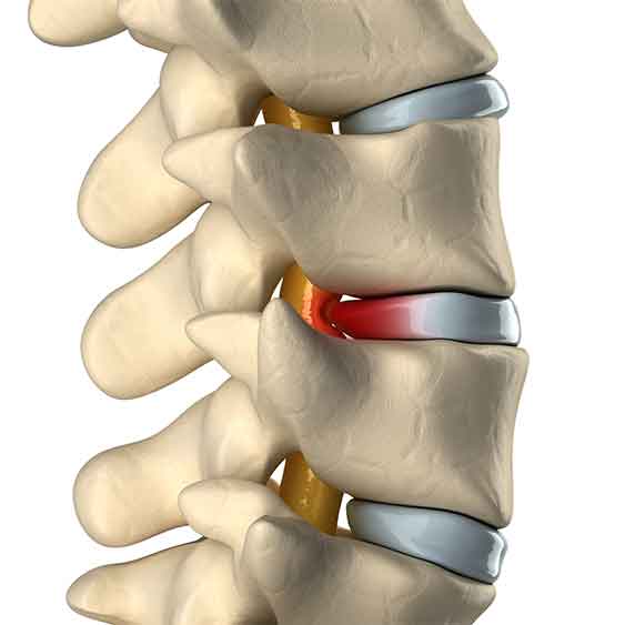 subluxation Πειραιας